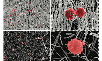 Novel streptavidin-functionalized silicon nanowire arrays for CD4+ T lymphocyte separation